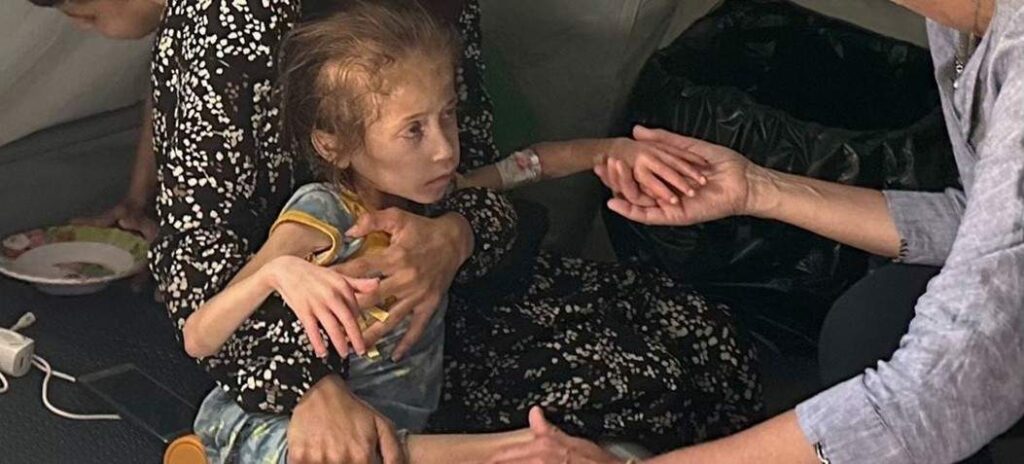 Hambruna Gaza