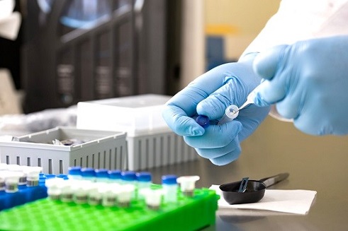 Negativa la detección de bacteria en lechugas a EUA
